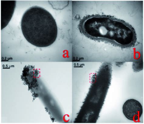 TEM images of bacteria (a) Bacillus thuringiensis and (b) Bacillus ...