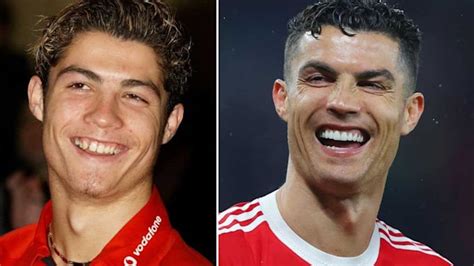 Cristiano Ronaldo smile transformation before and after: What has the footballer done to his ...