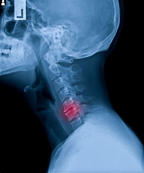 Is It Bad to Crack Your Neck? | Kasa Chiropractic