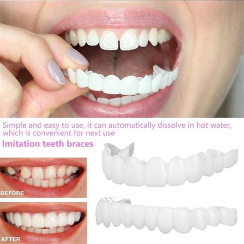 HOTBEST Smile eneers Snap On Upper False Teeth Dental eneers Dentures ...