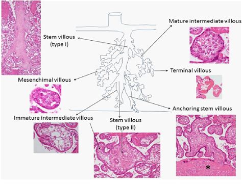 Figure 5 from Histology of Human Placenta | Semantic Scholar