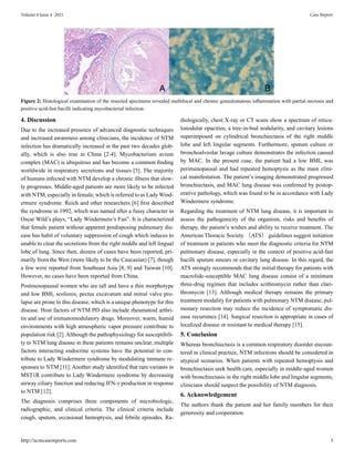 Repeated Hemoptysis With Progressive Bronchiectasis: A Case Report of ...