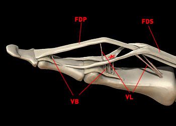 Flexor Tendon Injuries - Radsource