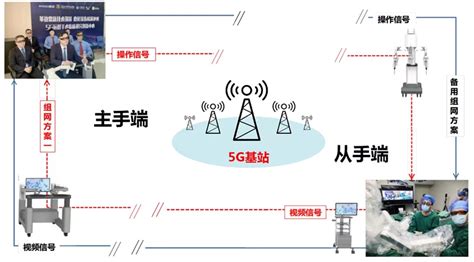 Breakthrough on Robot-assisted Laparoscopic Telesurgery with 5G Technology-天津大学教师个人主页英文版