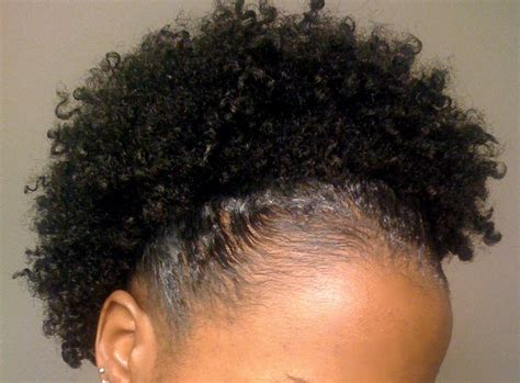 3 Hair Loss Conditions Caused By Natural Hair Practices | Black Girl ...