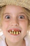 Rotten Teeth Stock Photos, Images, & Pictures - 335 Images