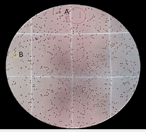 Microscope picture showing viable cells and non-viable cells A (red... | Download Scientific Diagram