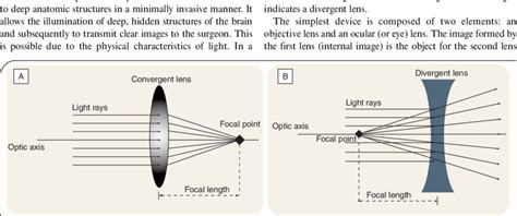 (A) Example of a convergent biconvex lens. (B) Example of a divergent... | Download Scientific ...