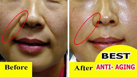 BEST ANTI AGING FACE MASK AT HOME | BEST ANTI WRINKLE FACE MASK FOR AGING SKIN TIGHTENING - YouTube