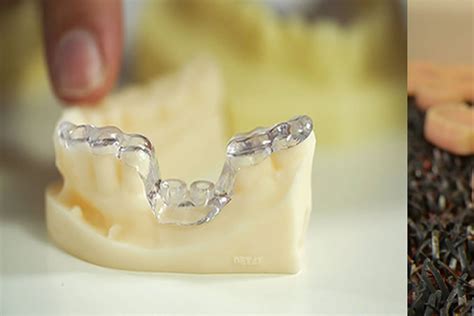 STPL3D- 3D printed Dentures can be used for elderly people.