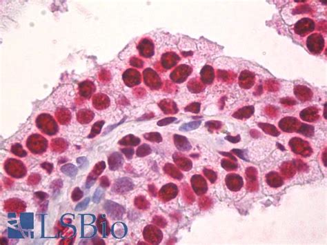 IHC-plus™ Sm / Smith Monoclonal Antibody Mouse anti-Human | LSBio