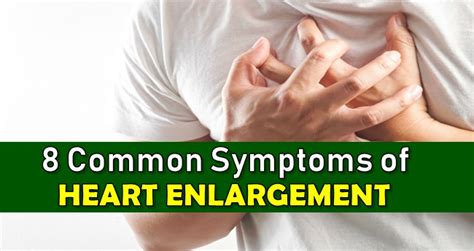 Heart Enlargement Symptoms - 8 Warning Signs Of Mild Cardiomegaly