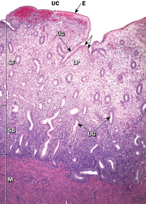 Histology of Uterus (Proliferative Phase 1) Diagram | Quizlet