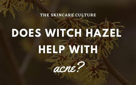 Does Witch Hazel Help With Acne?