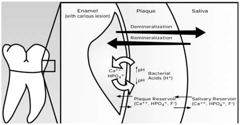 Demineralization of Teeth: How They Become Weakened - 1311 Jackson Ave Dental | Dentist in Long ...