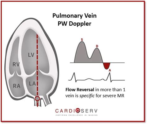 Echocardiography – Artofit