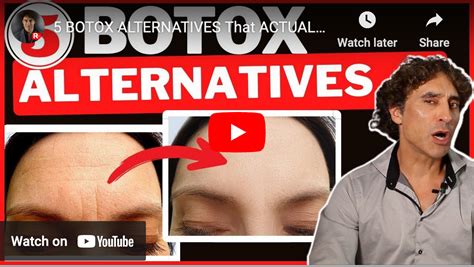 5 BOTOX ALTERNATIVES That ACTUALLY WORK!!