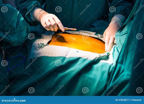 Incision Stock Photo - Image: 41064877