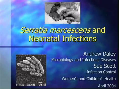 PPT - Serratia marcescens and Neonatal Infections PowerPoint Presentation - ID:1281095