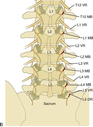 Lumbar Medial Branch Nerve Block