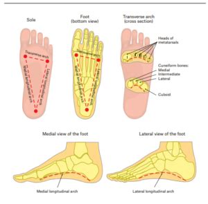 Pes Planus/Adult Acquired Flatfoot Deformity | PM&R KnowledgeNow