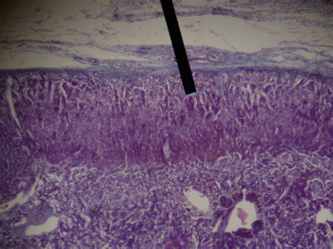 Zona glomerulosa - wikidoc