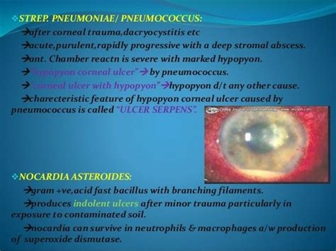 Corneal ulcer d/t Nocardia asteroides resembles Fungal Corneal ulcer ...