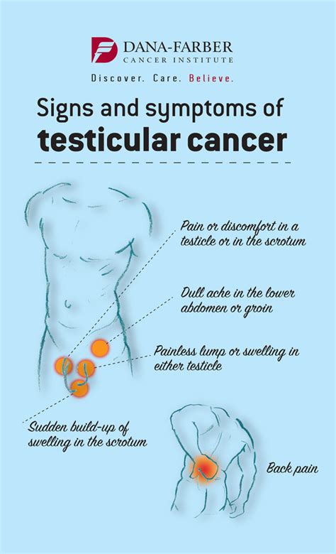 Treatment of Testicular Cancer in Young Men | Dana-Farber Cancer Institute