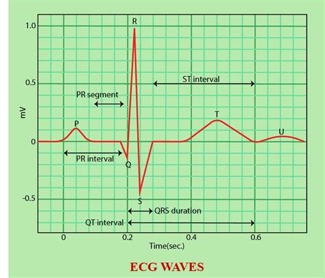 In ECG, the P-R interval corresponds to(a) Time delay in A-V node (b) S-A nodal conduction time ...