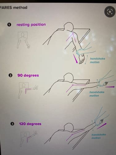 Shoulder reduction techniques Flashcards | Quizlet