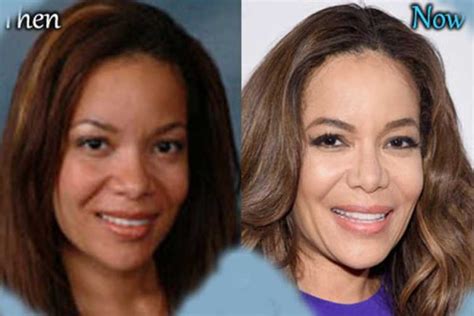 Sunny Hostin Plastic Surgery: Nose Job, Botox, Facelift