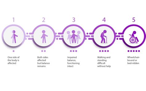 Exploring the 5 Stages of Parkinson's Disease