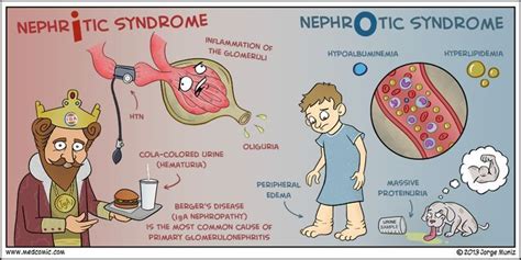 an image of nephtic syndrome