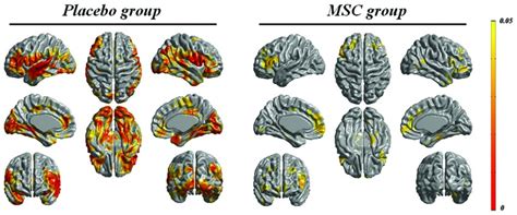 Longitudinal changes in cortical thickness in both groups. The areas of... | Download Scientific ...