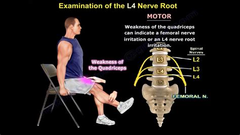 Examination Of L4 Nerve Root — OrthopaedicPrinciples.com