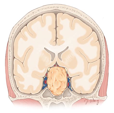 Pituitary Gland Anatomy | Expert Surgeon | Aaron Cohen-Gadol, MD