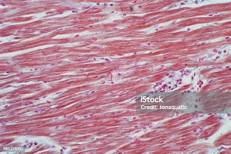 Histologi Otot Jantung Manusia Di Bawah Pandangan Mikroskop Untuk Pendidikan Foto Stok - Unduh ...