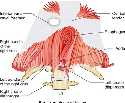 Hiatus Anatomy - Anatomical Charts & Posters