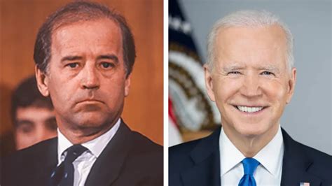 Joe Biden’s Hair Transplant: What You Need to Know | Estenbul Health