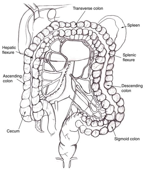 What Is Aortogram With Runoff - Website of ruwacurd!