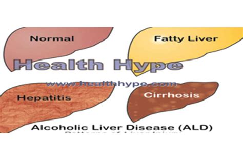 Abnormal Liver Enzymes