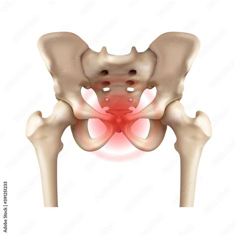 Human pelvic bone with highlighting of the area of pain in the symphysis pubis. Vector ...