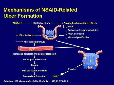 Balancing Cardiovascular Risks and Gastrointestinal Outcomes in NSAID Users