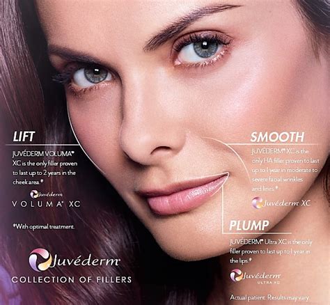 JUVÉDERM® Fillers – Body Contouring | Doucet Medical Spa | Botox Cosmetic