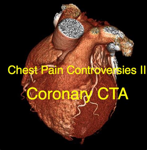 Chest Pain Controversies: Coronary CTA Use (Part 2) - emdocs
