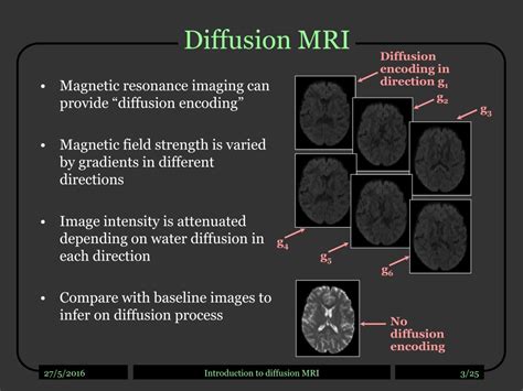 PPT - Introduction to diffusion MRI PowerPoint Presentation, free download - ID:9429596