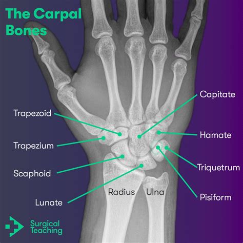 Carpal Bone Mnemonic And Names: Wrist Anatomy Made Easy —, 56% OFF
