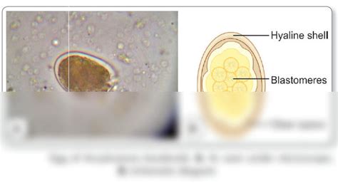 SOLUTION: Nematodes ancylostoma duodenale morphology egg - Studypool