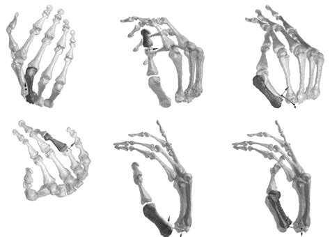 Skeleton Hand Reference
