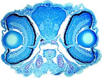 » Zebrafish models of human disease - Ralf Dahm